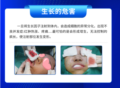 生长因子注射对人体有伤害吗？
