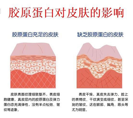 胶原蛋白与水光针怎么搭配使用